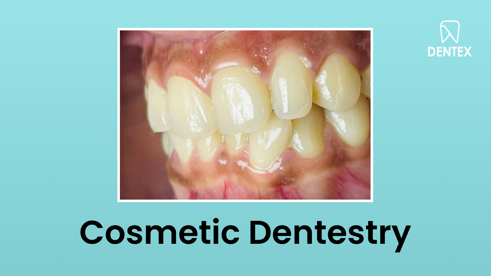 placeholder-landscape