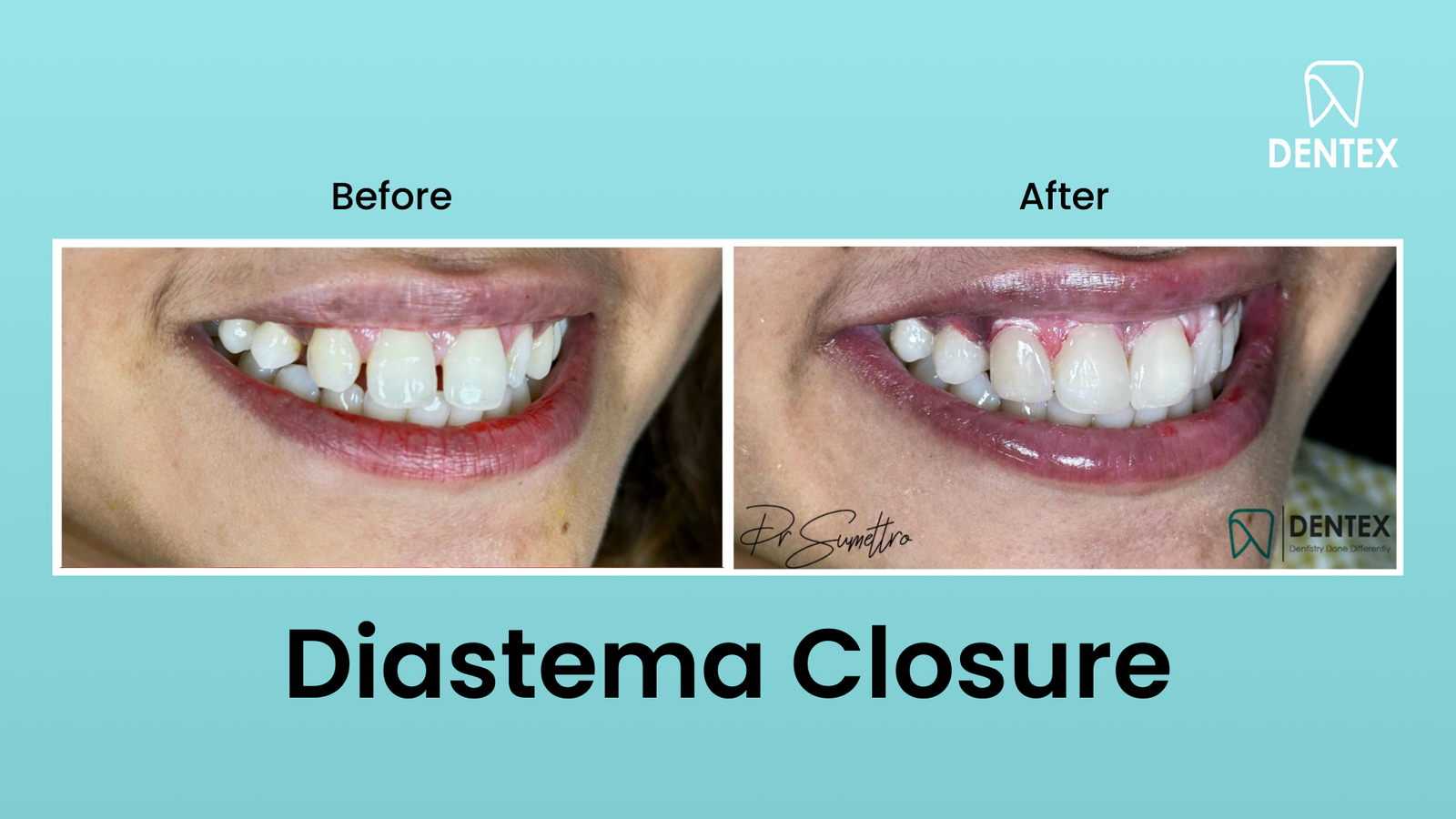 placeholder-landscape