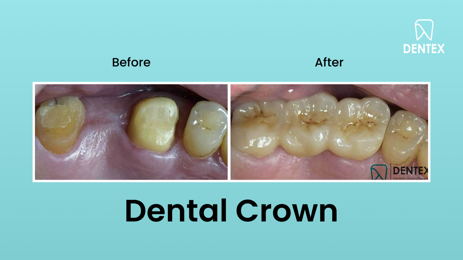 placeholder-landscape