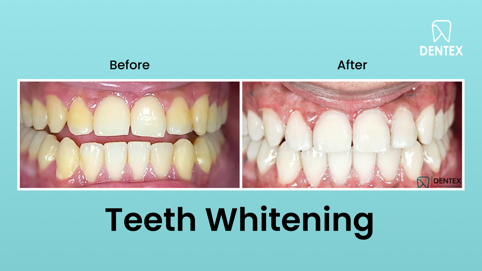 placeholder-landscape